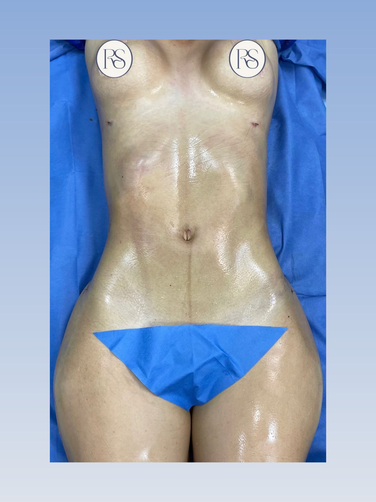 Ricardo Sánchez Mata-3