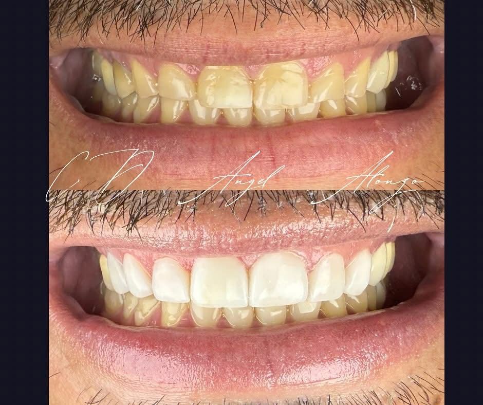 Martha Alicia Ceniceros Betancourt-21