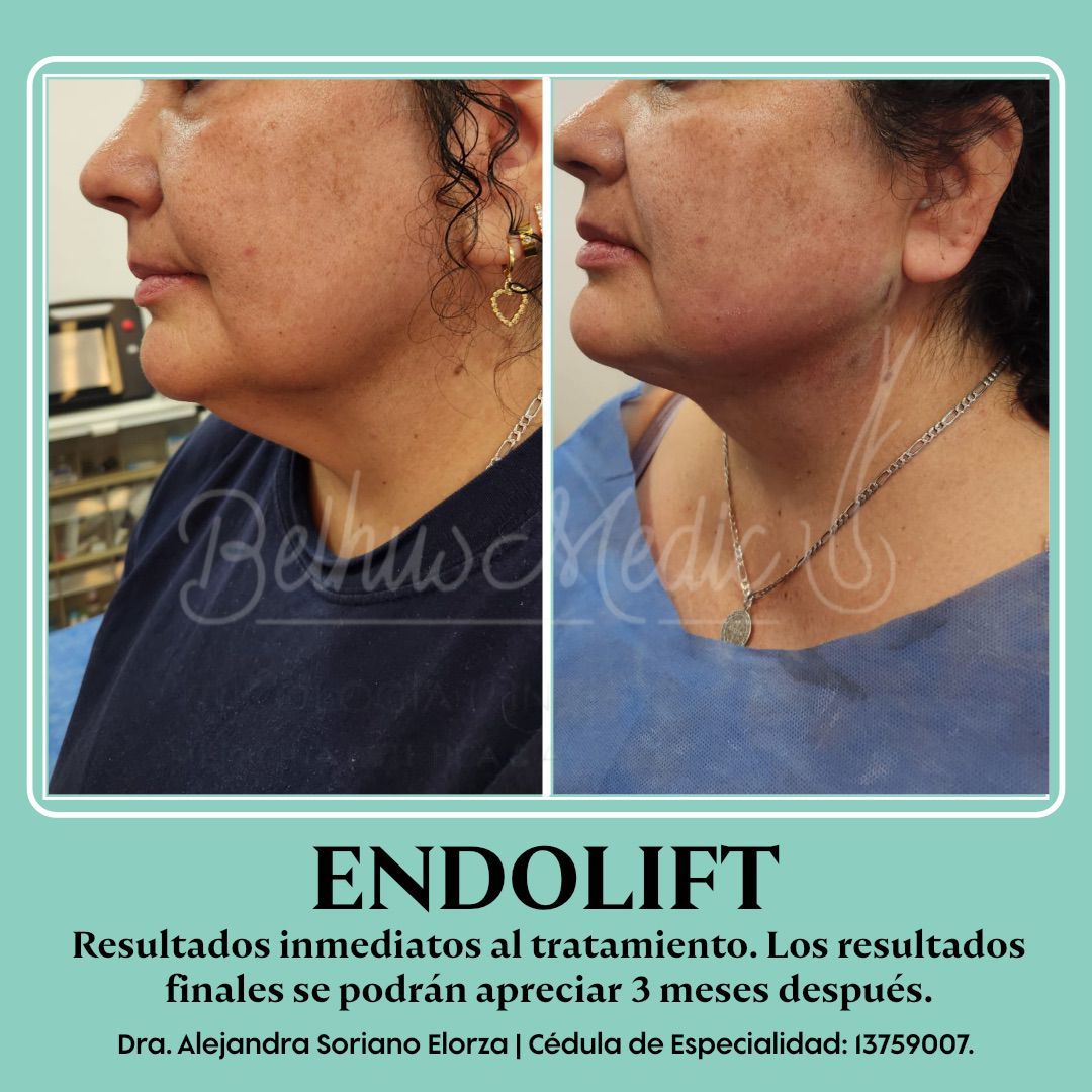 Alejandra Soriano Elorza-17