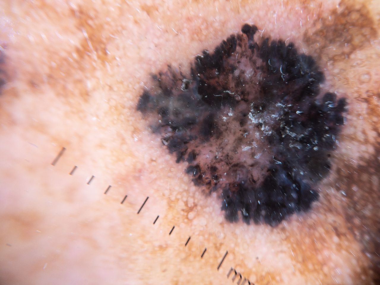 Lauro Francisco Varela Coronado-9