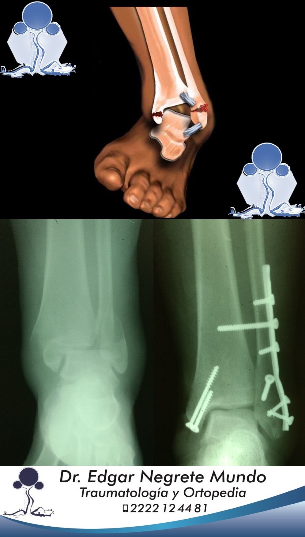 Edgar Negrete Mundo-3