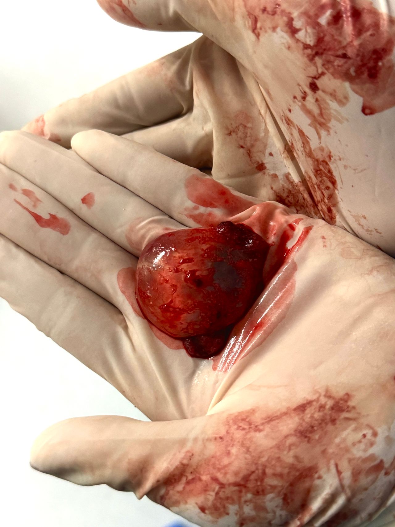 Amairani Yaneiri Mercado Rivera-3