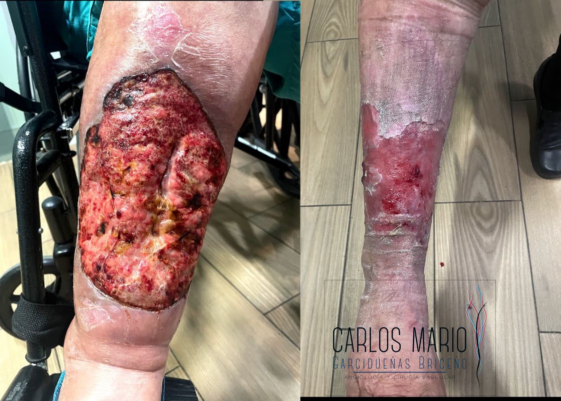 Carlos Mario Garcidueñas Briceño-5