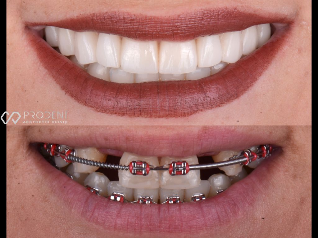 Ulises Pérez Murillo-88