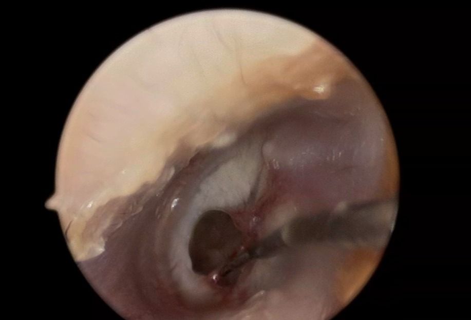 Edgar Paul Salas Lira-3