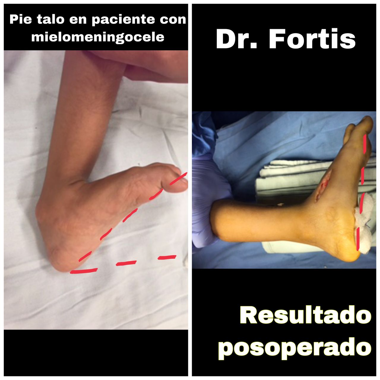 Ignacio Osvaldo Fortis Olmedo-16