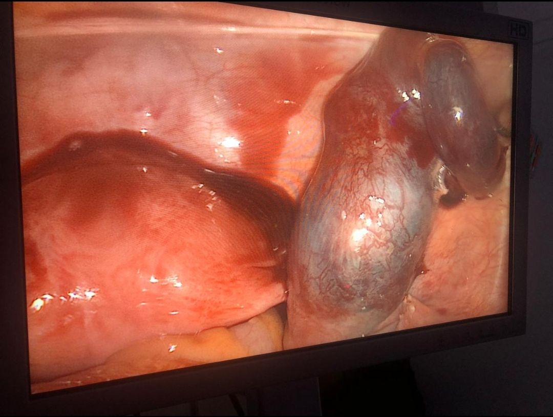 Ricardo Adame Pinacho-4