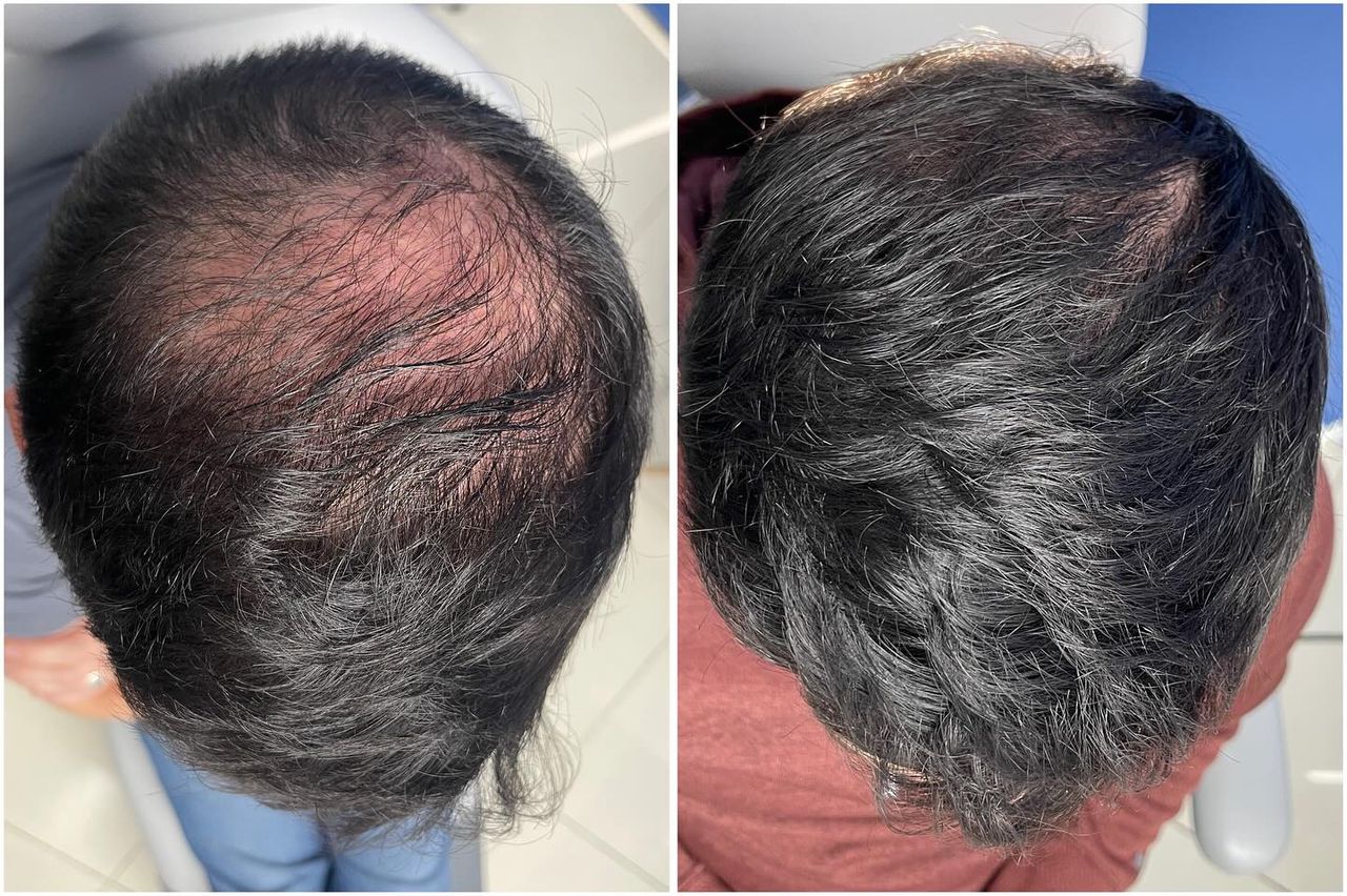 Adrián Martínez Moreno-1