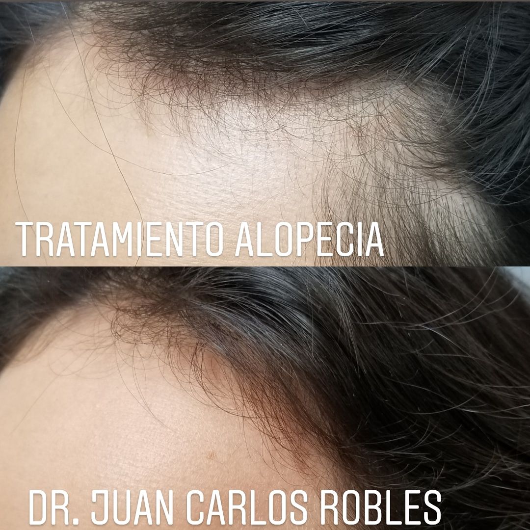 Juan Carlos Robles Méndez-34