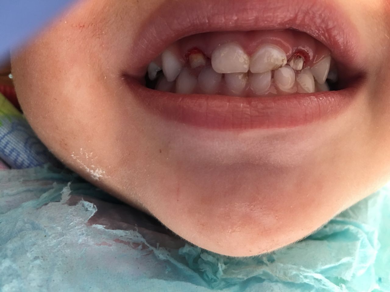 Patricia Rizo Palos-15