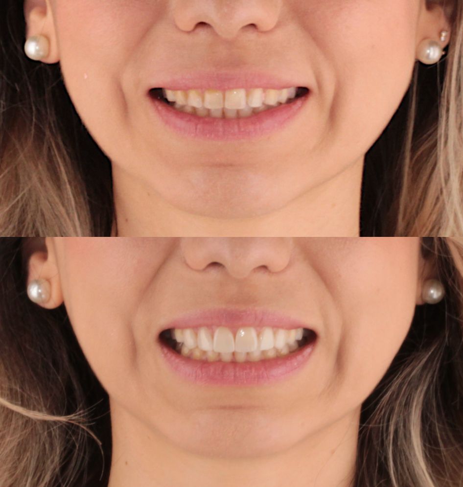 Aide Montserrat Orozco Gutierrez-19