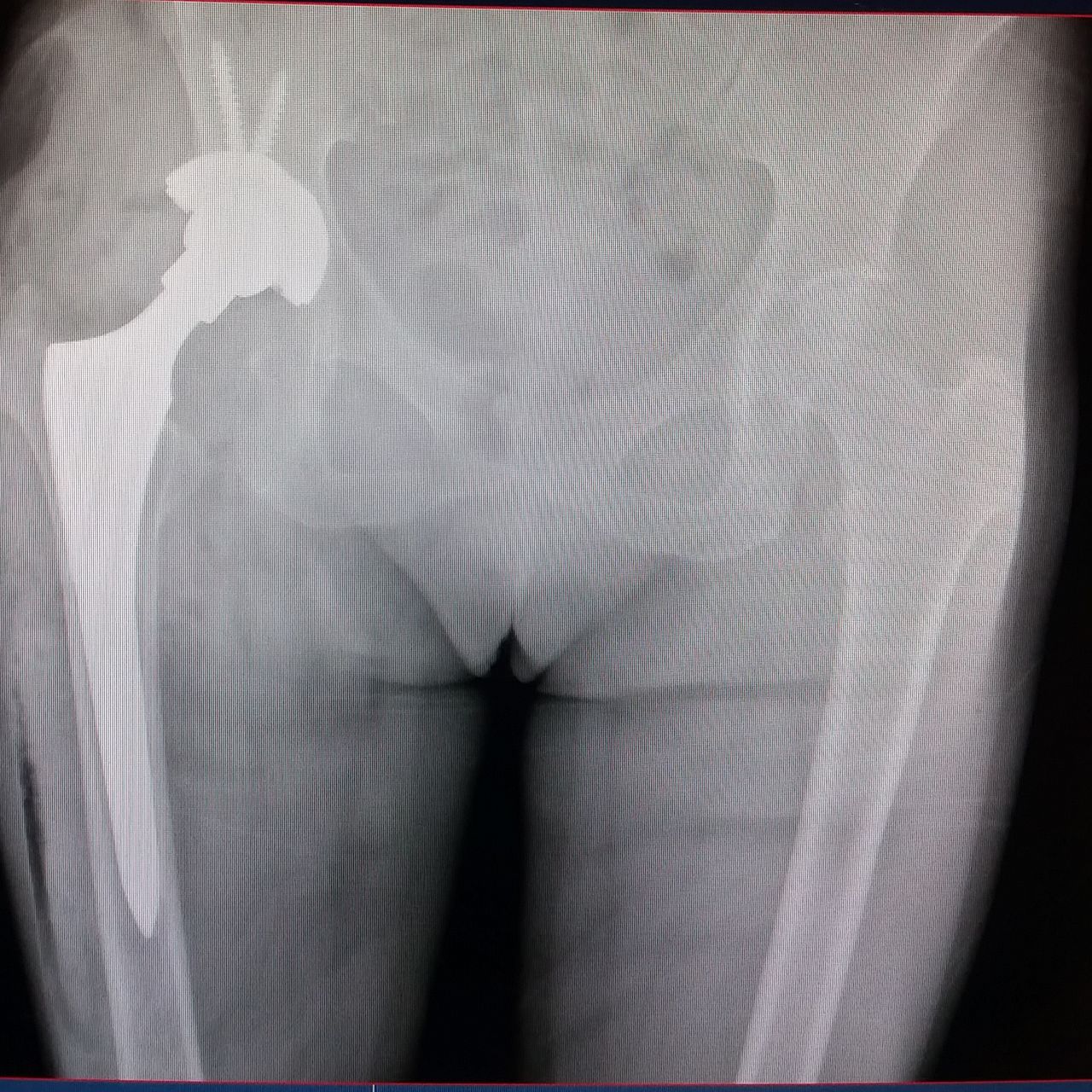 Sergio Torrecillas Serna-38