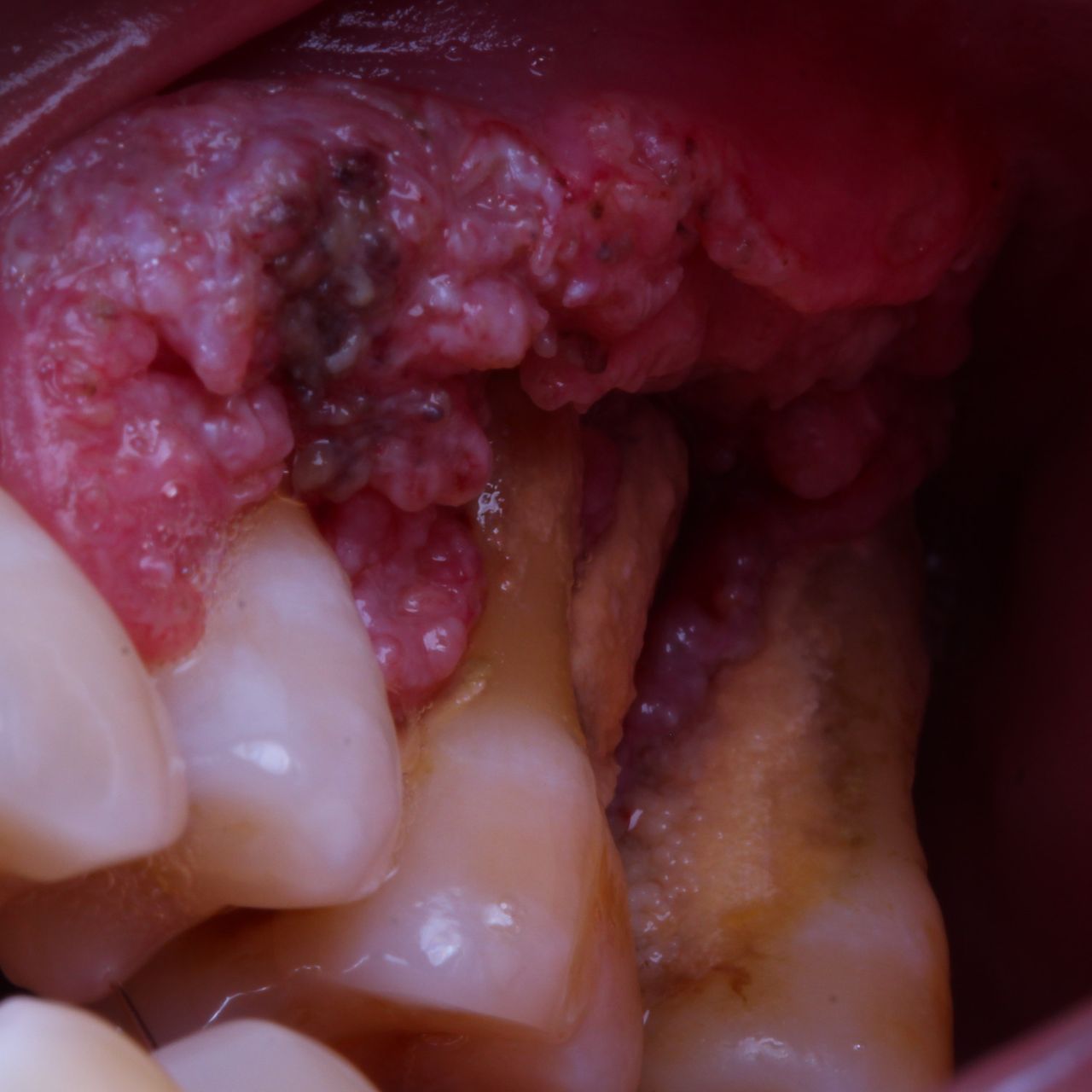 Hugo Enrique Aguilar Lamas-103