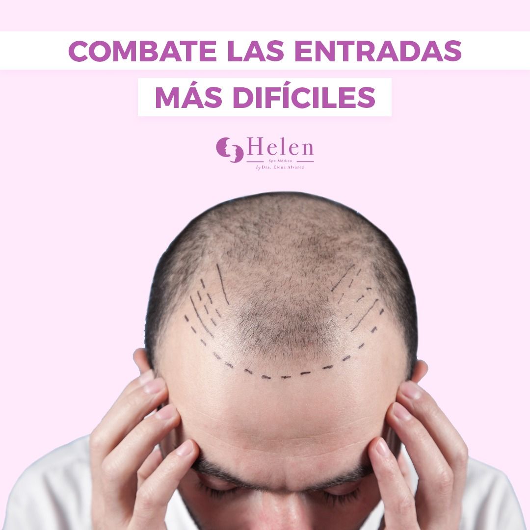 Elena Alvarez Velazquez-14