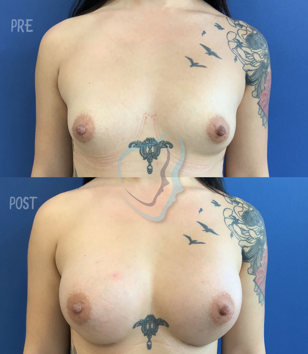 Giuseppe Tanzillo-62