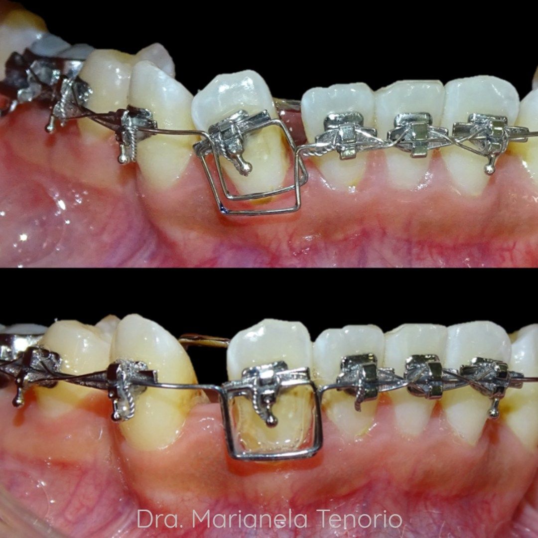 Marianela Tenorio-11