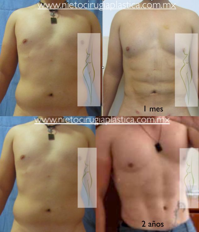 Rubén Nieto Balcázar-7