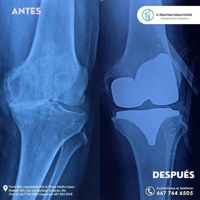 Miguel Ángel Espinoza Urcisichi-1