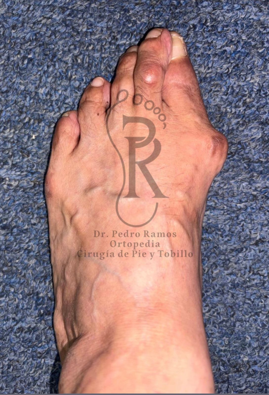 Pedro Ramos Jurado-6