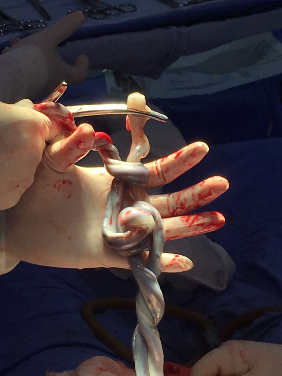 Hilda Rguez Zubieta-1