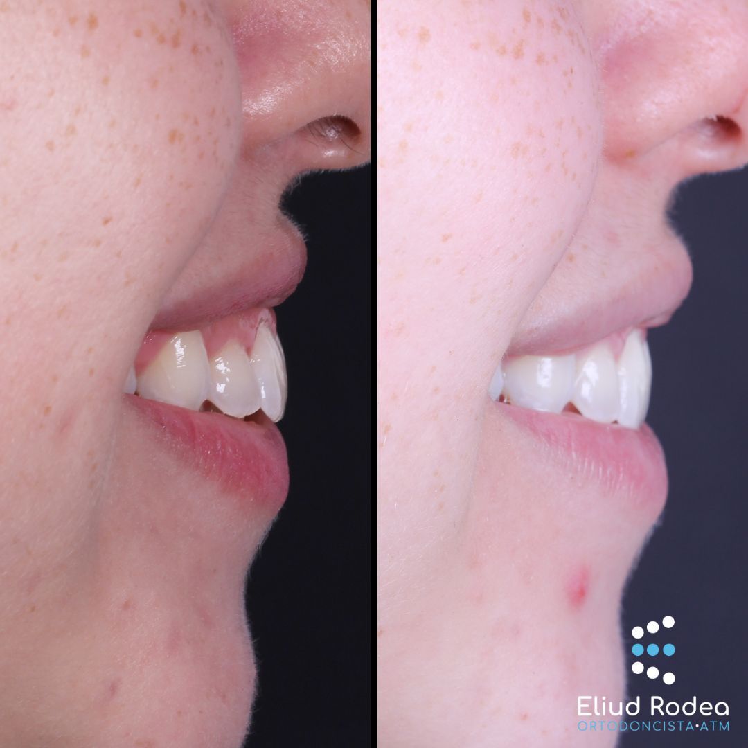 Eliud Rodea Monsivais-1