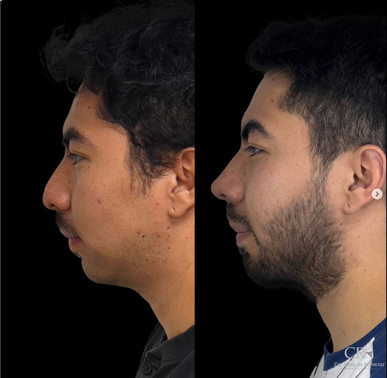 Carlos Alfonso Romero Gameros-26