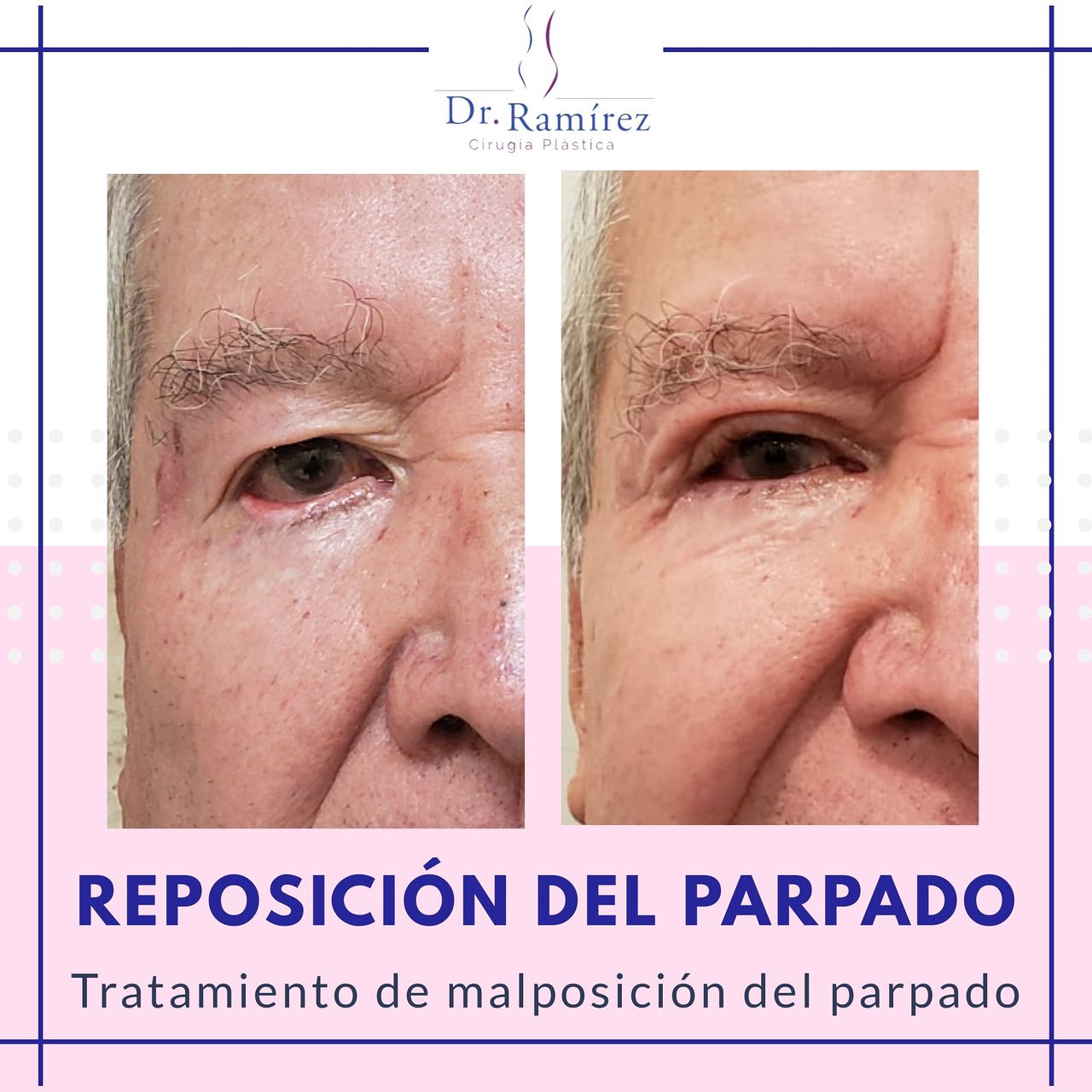 Edgar Ramírez López-79