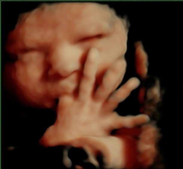 Alfredo Fernández-4