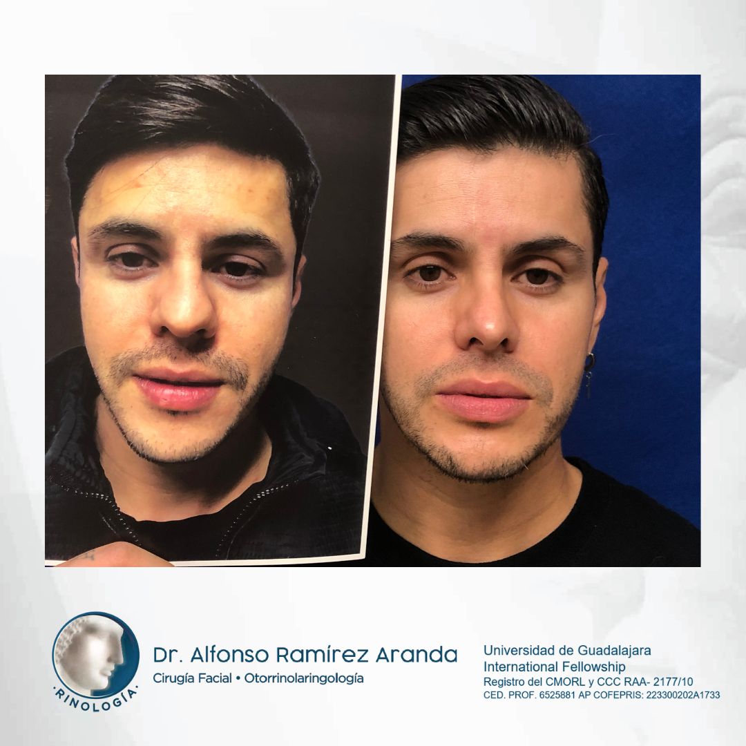 Alfonso Ramírez Aranda-28