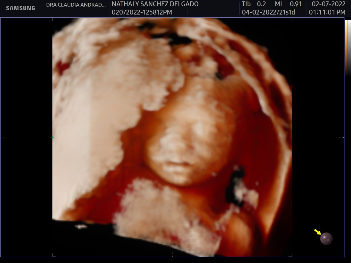 Claudia Andrade Ruano-0