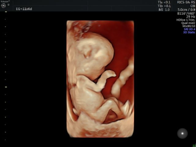 Katia Yareli Viera Ibarra-4