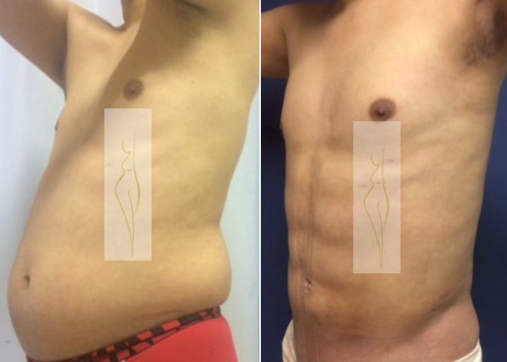 Rubén Nieto Balcázar-5