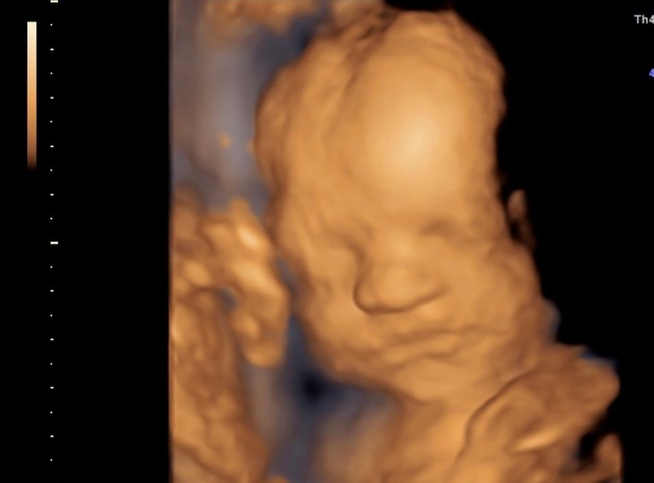 Blanca Esthela Rosales De La Garza-1