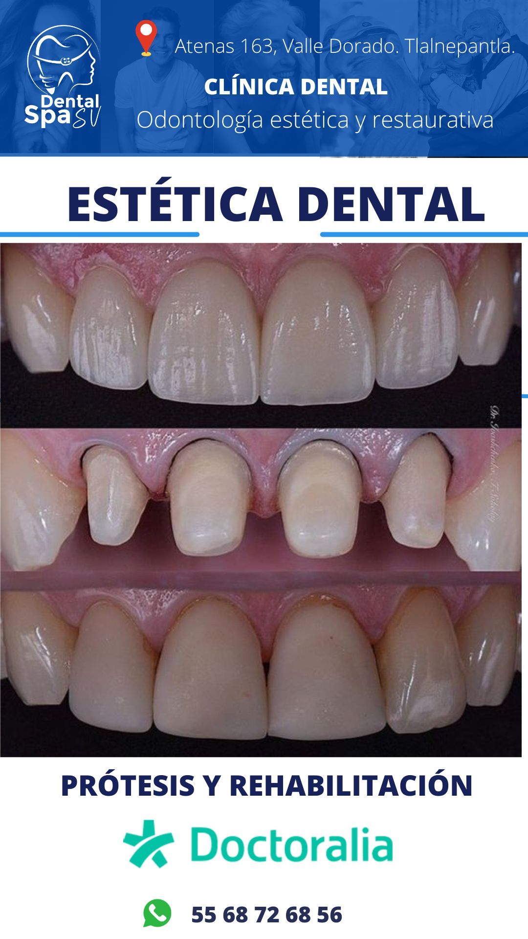 Zury Sarai Moreno Soto-27