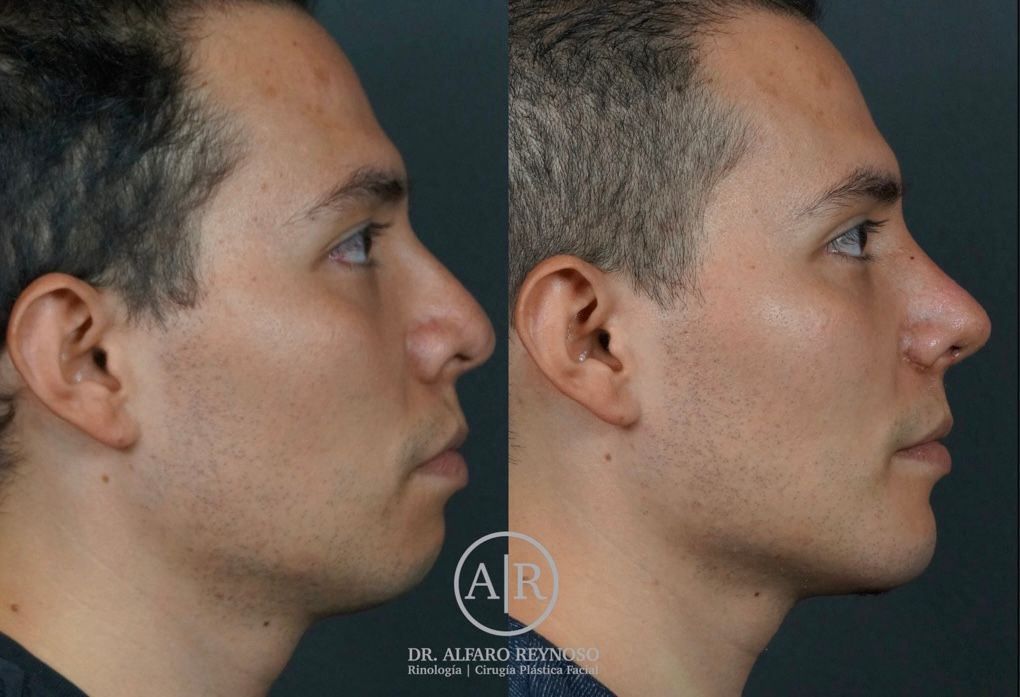 Jose Alberto Alfaro Reynoso-4