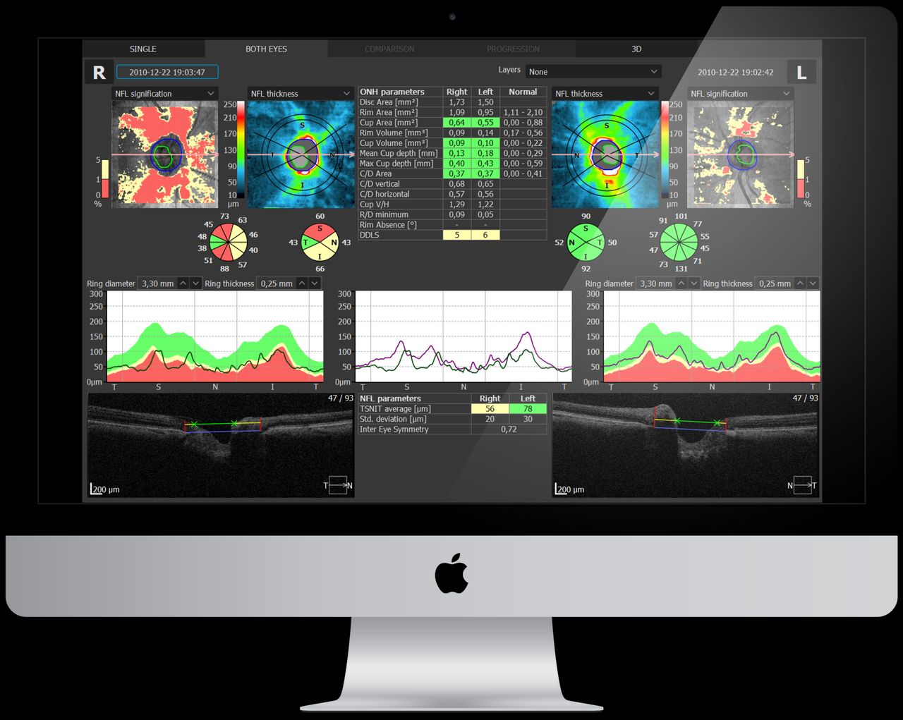 Milton M. Maldonado  Reinoso-28