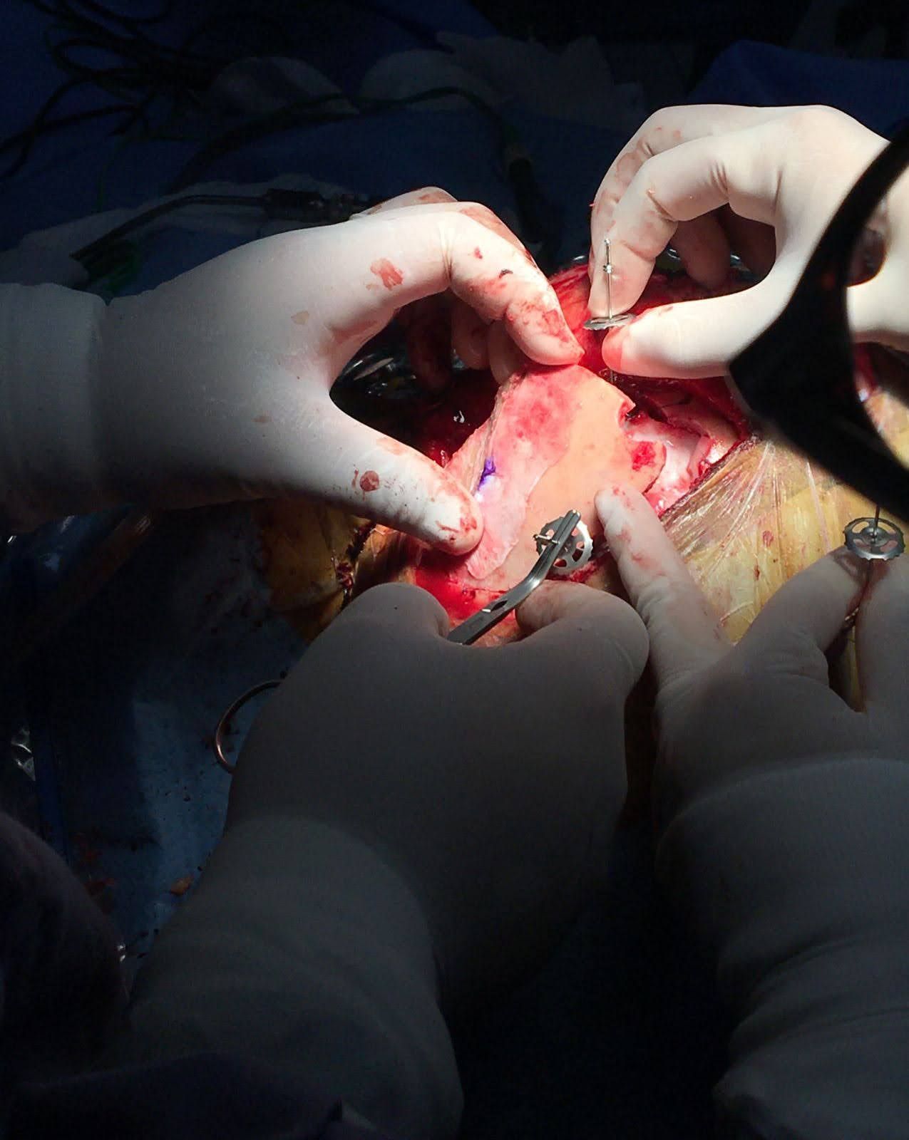 Gerson Reyes Rodríguez-66