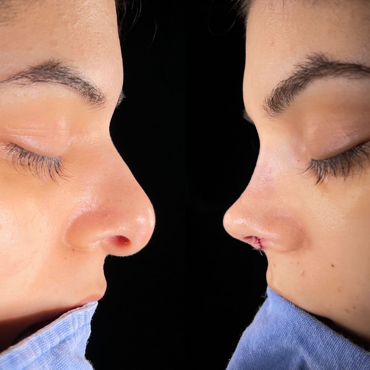 Angel Castro Urquizo-174