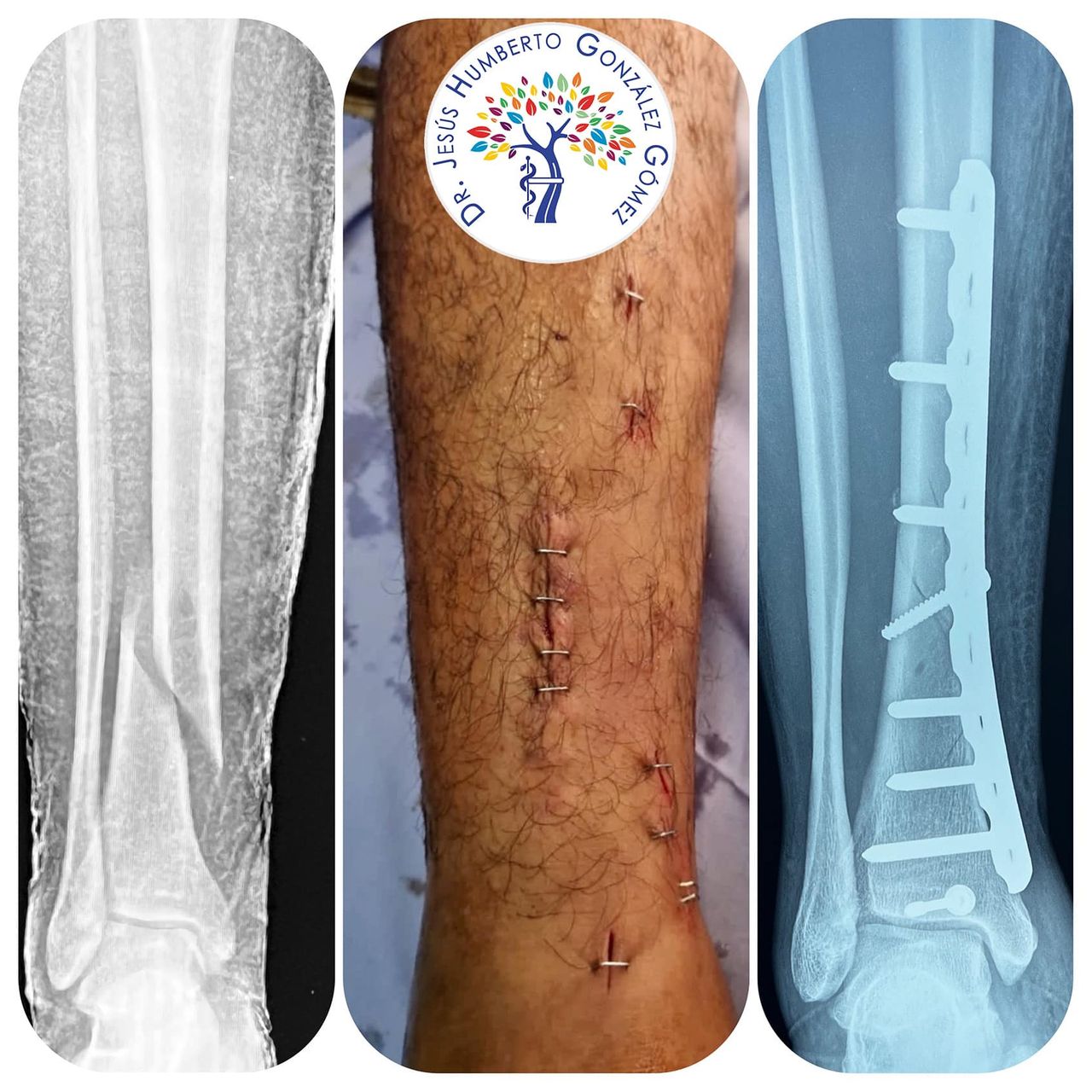 Jesús Humberto González Gómez-23