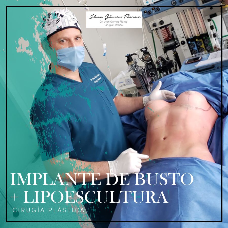 Jhon César Gómez Florez-51