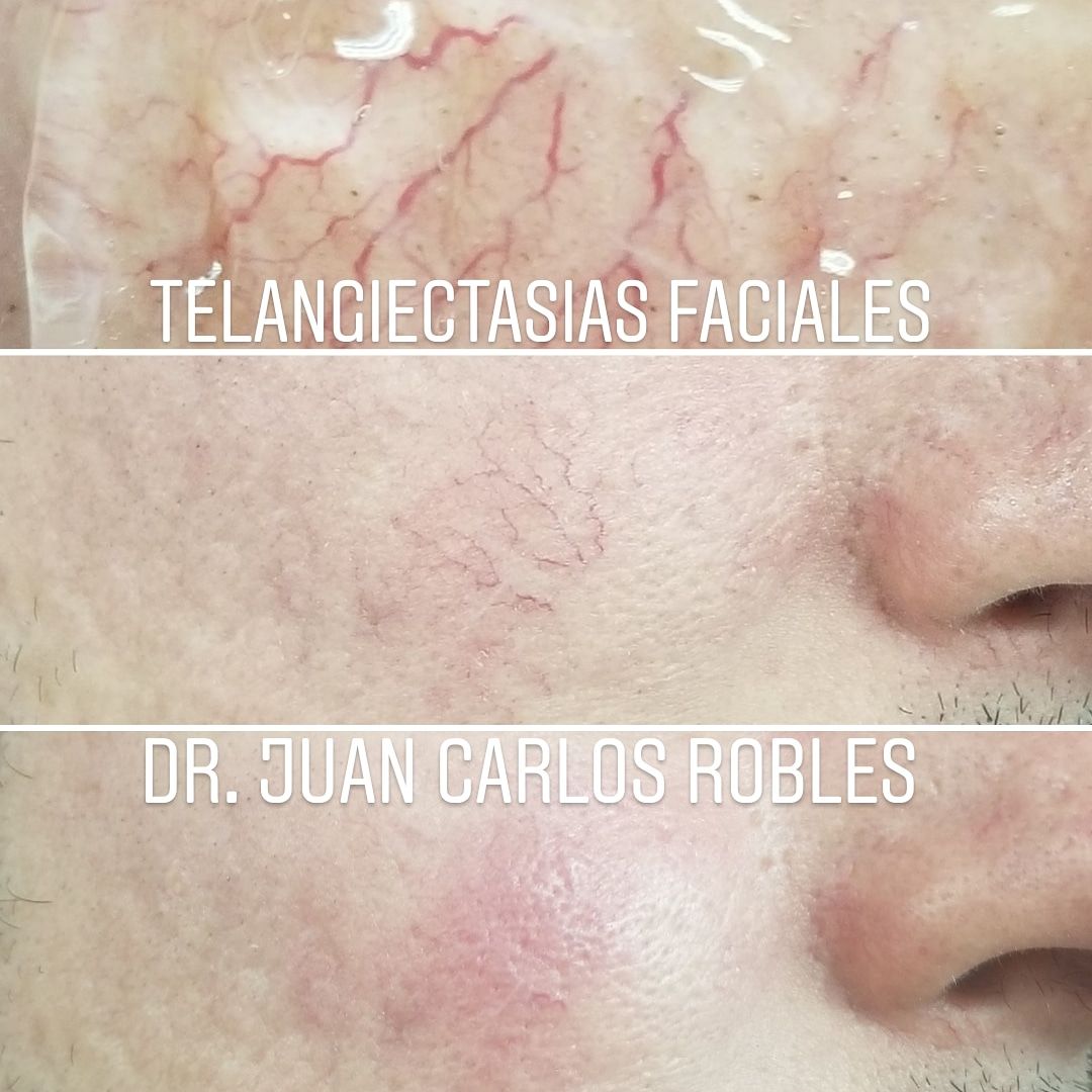 Juan Carlos Robles Méndez-31