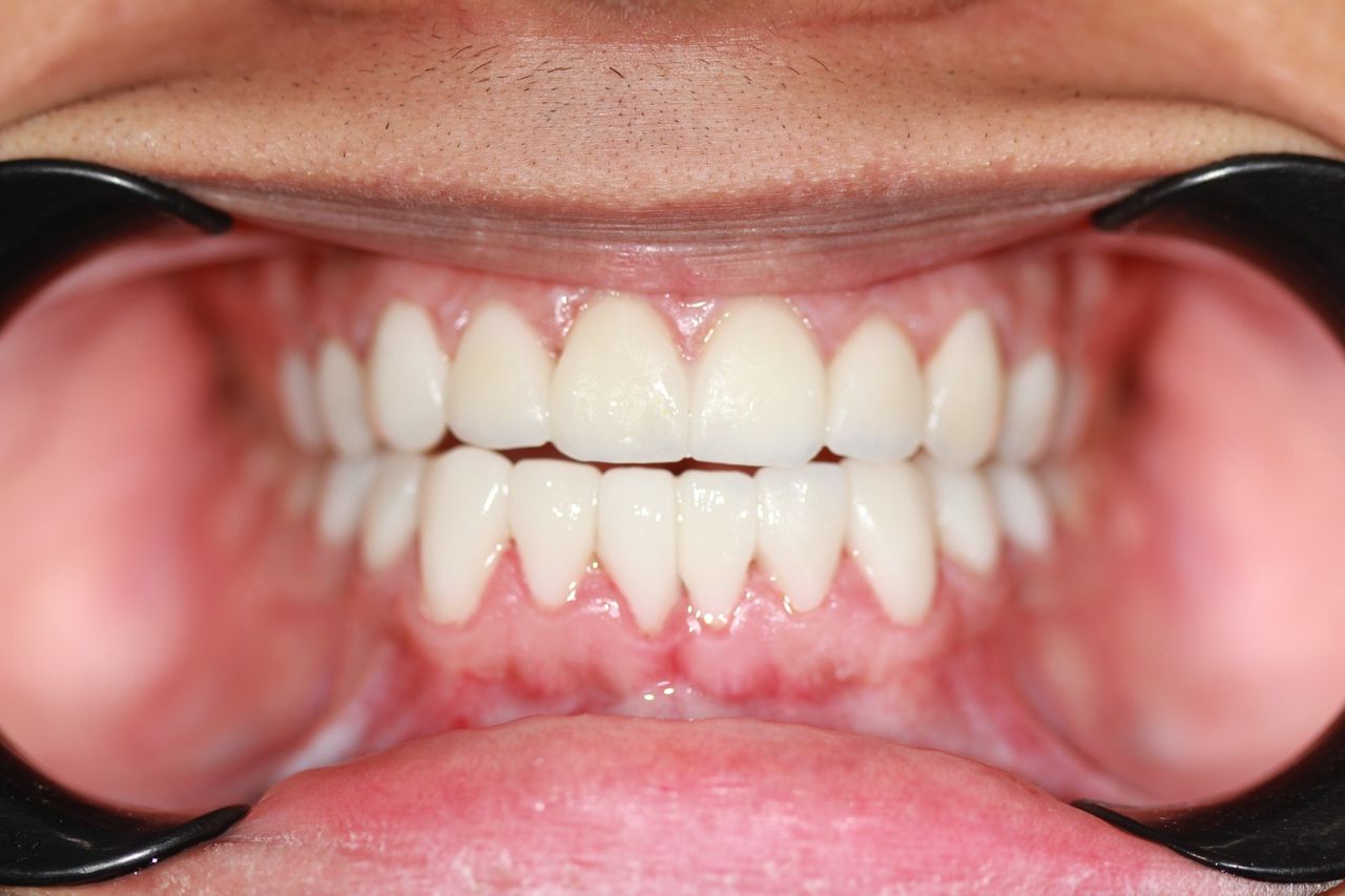 Mauricio Burgos Sánchez-13