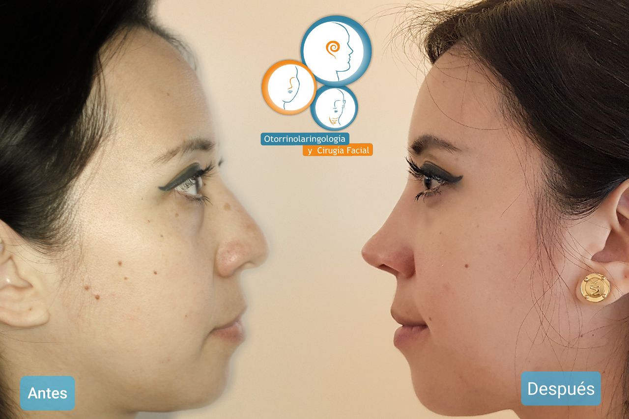 José Christian Ávila Romero-8