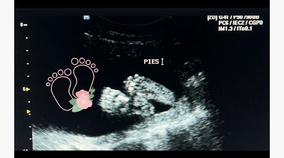 Ana Itzel Gaona Guevara-2