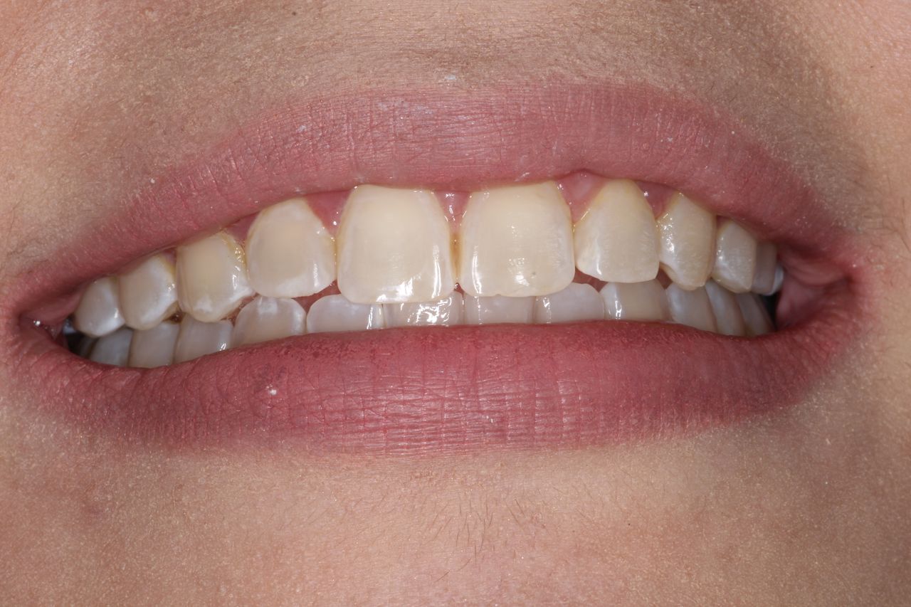 Sergio Torres Rivera-9