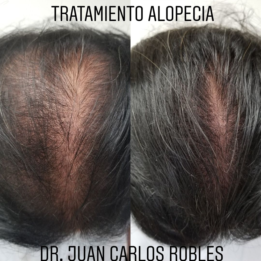 Juan Carlos Robles Méndez-20