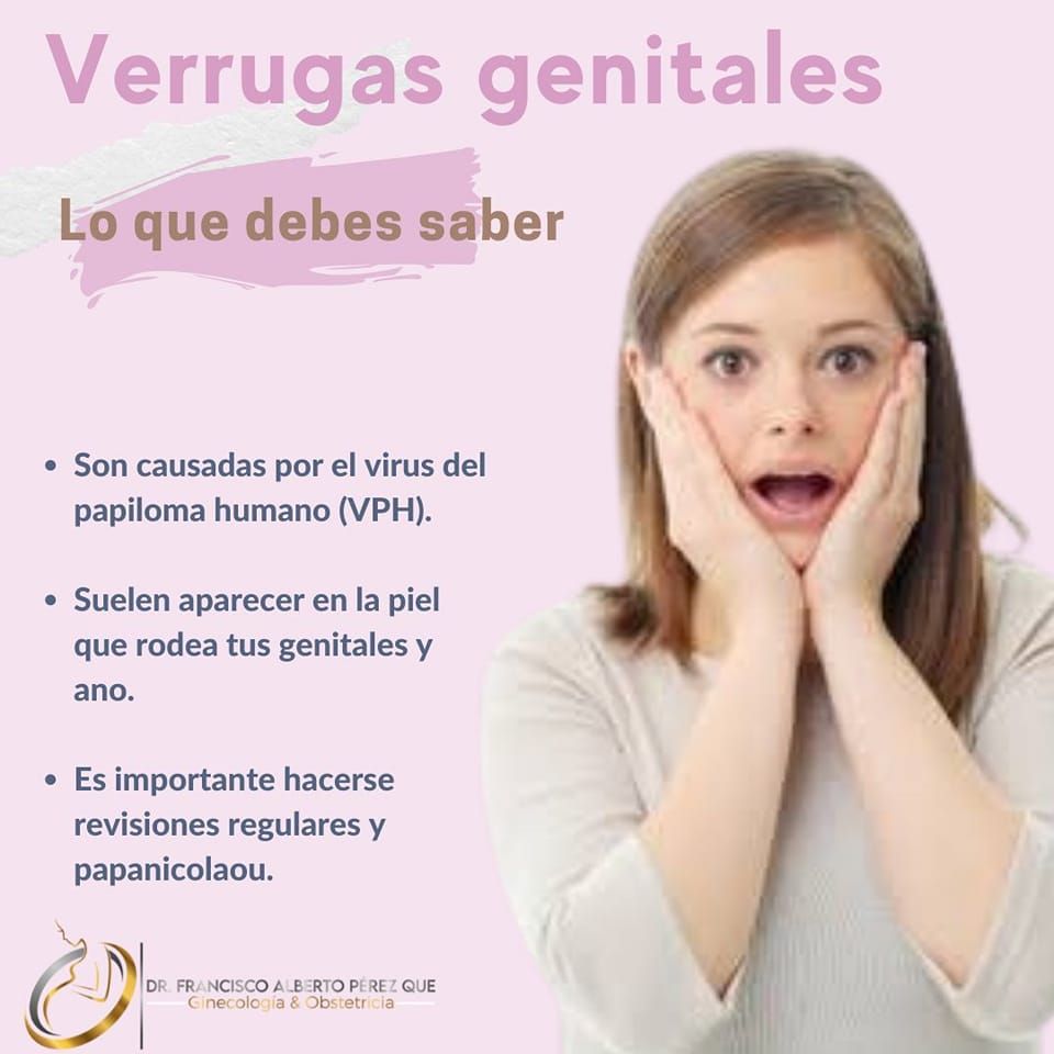 Francisco Alberto Perez Que-9