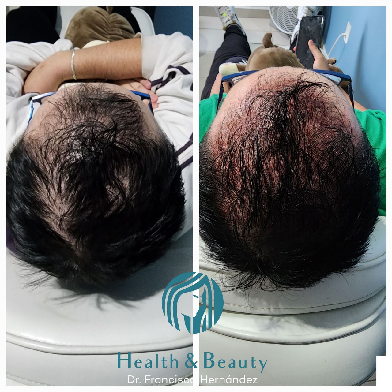 Francisco Hernández Gómez Crespo-75