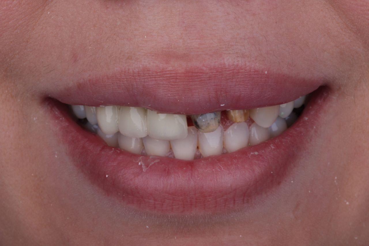 Daniel Perez Parcero-3