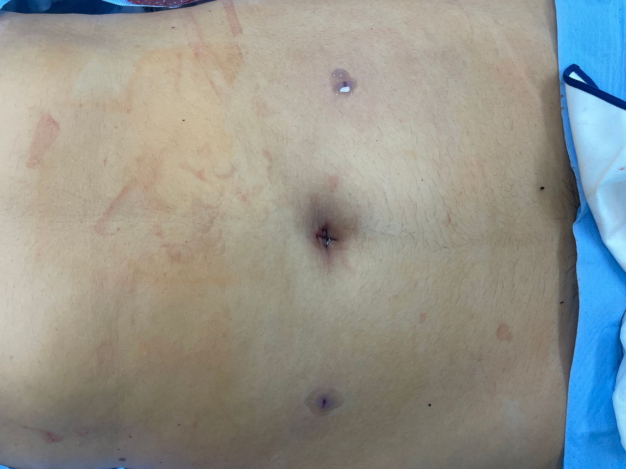 Ferstman Duran Hernandez-12